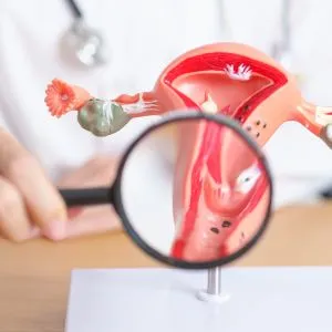 Gynae Cancer Surgery
